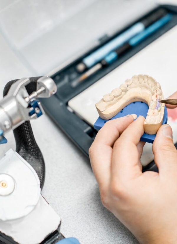 Dental Model