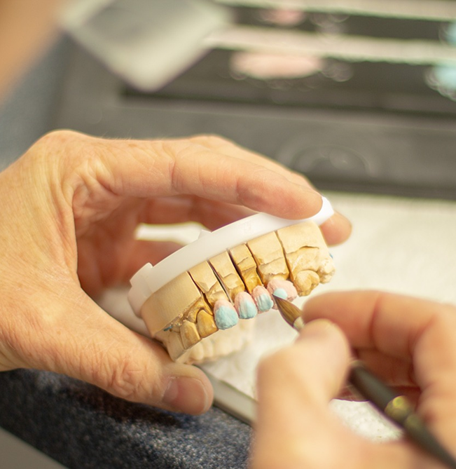 Dental work